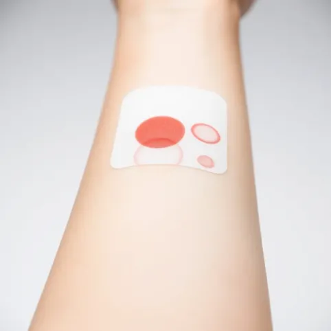 Testy alergiczne pokarmowe jak wyglądają