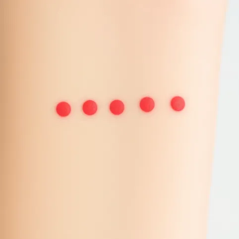 Testy alergiczne skórne ile trwają