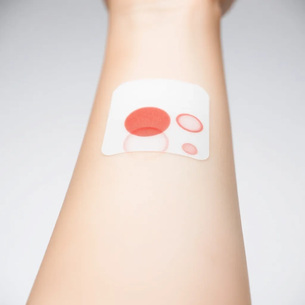 Testy alergiczne pokarmowe jak wyglądają